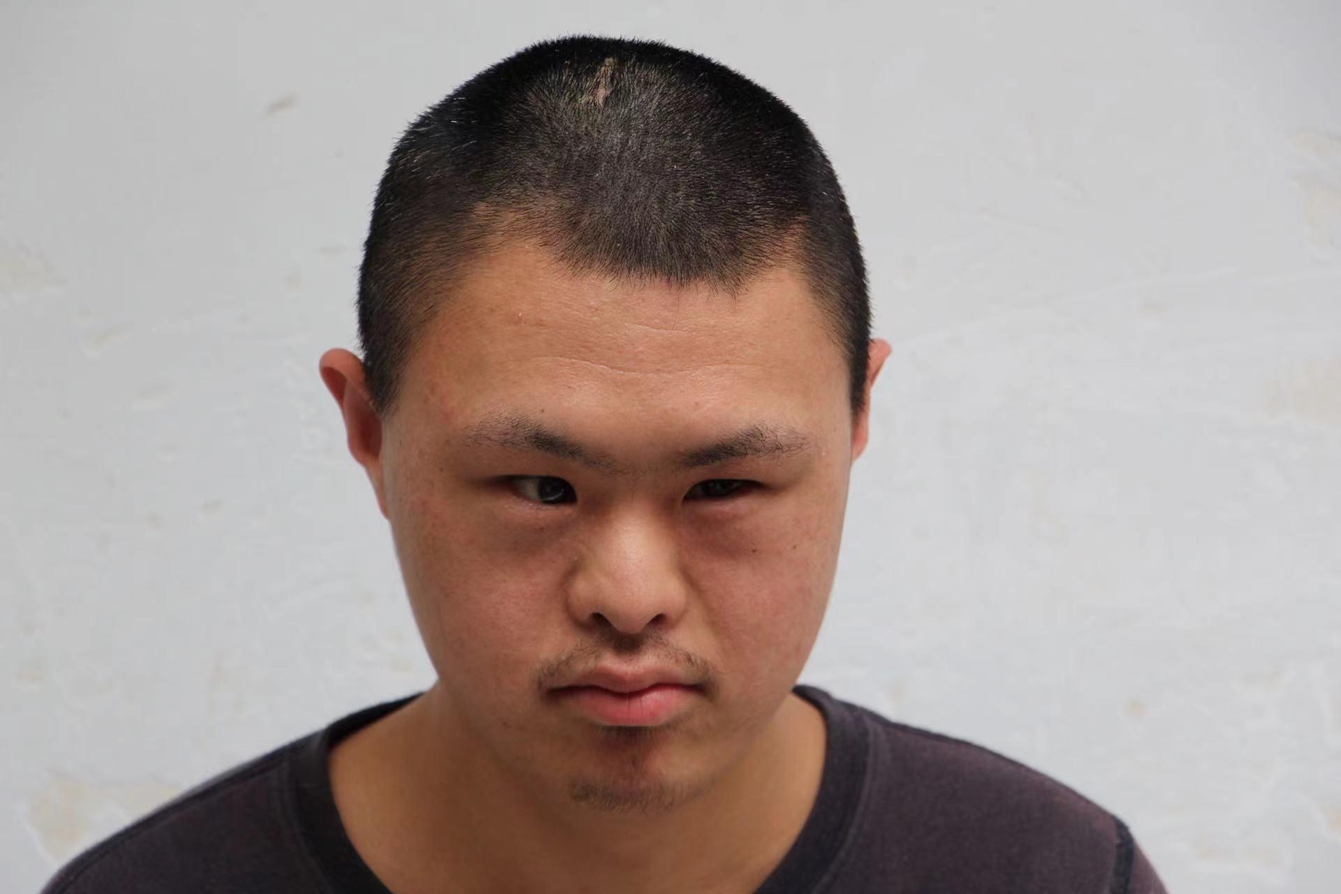 走失者照片 临沂寻亲：15岁男孩被救助，高1米...