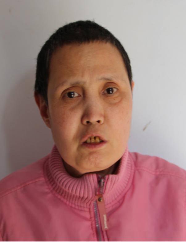 走失者照片 临沂寻亲：六旬老太被救助多年，高1...