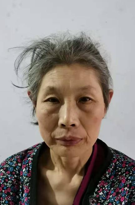 走失者照片 临沂寻亲：中年女子被救助，高1米6...