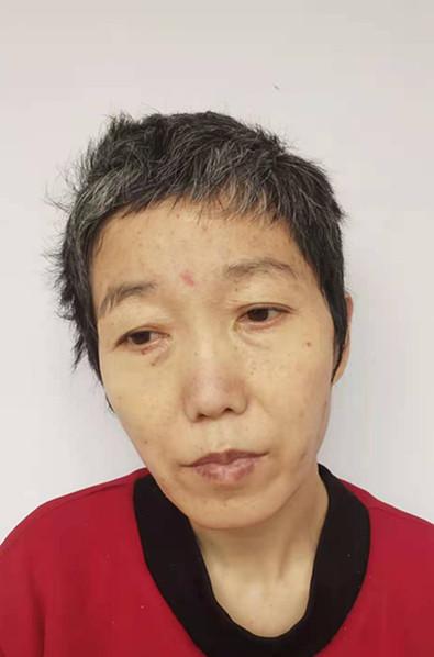 走失者照片 急寻家属：临沂五旬女子被救助多年，...