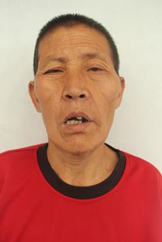 走失者照片 临沂寻亲：中年女子被救助，高1米6...