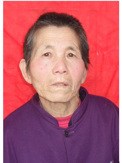 走失者照片 临沂寻亲：六旬老太被救助，精神异常...