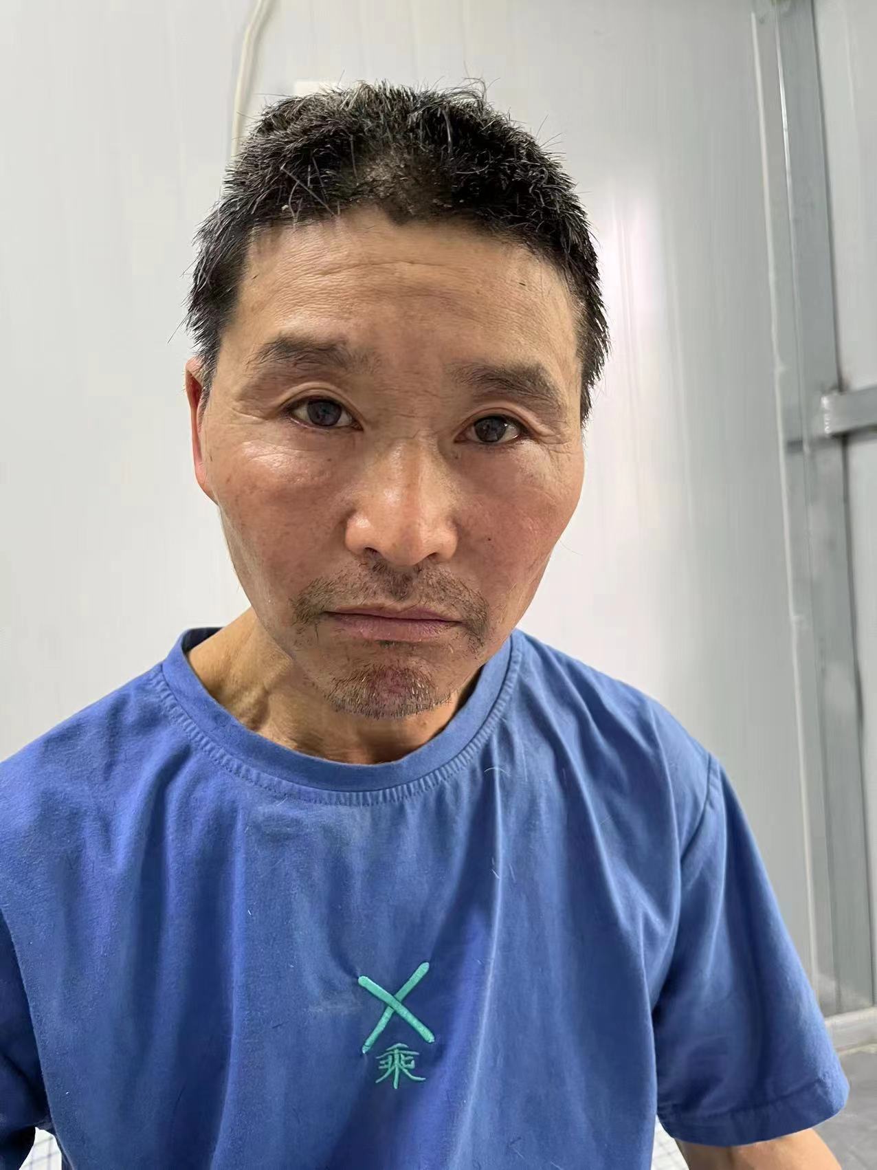 走失者照片 合肥寻亲：五旬男子被救助，自述叫杨...