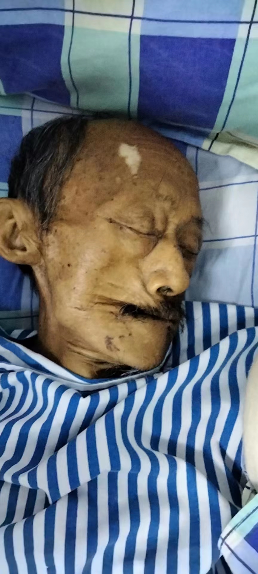 走失者照片 寻亲：海南昌江七旬老人被救助，因病...