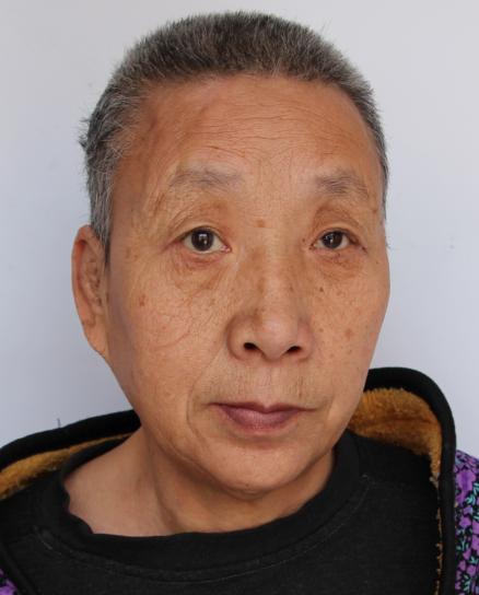 走失者照片 临沂寻亲：五旬女子被救助多年，高1...