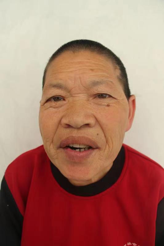 走失者照片 临沂寻亲：五旬女子被救助十余年，口...