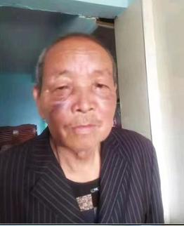走失者照片 福州急寻：七旬老人失联，穿深咖色西...