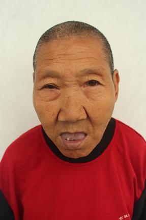 走失者照片 临邑寻亲：五旬女子被救助，高1米6...