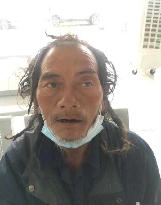 走失者照片 漳州寻亲：五旬男子被救助，自称是四...