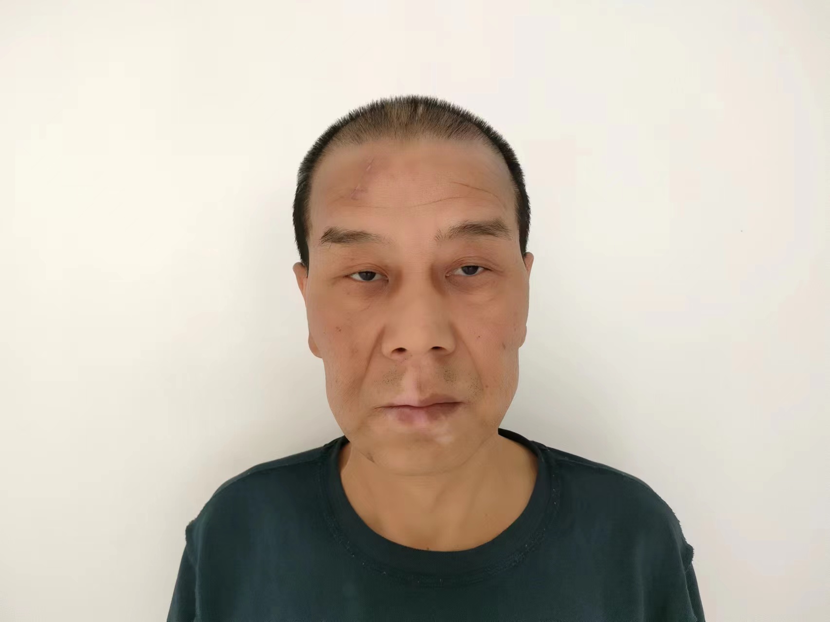 走失者照片 三亚寻亲：五旬男子被救助，名叫张兰...