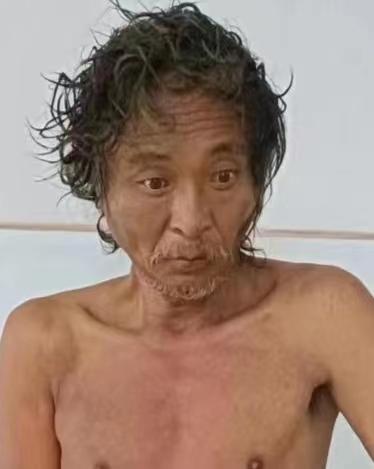 走失者照片 南宁寻亲：六旬老人被救助，上身赤裸...
