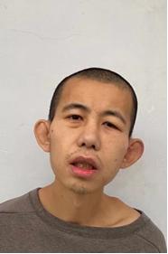 走失者照片 临沂寻亲：18岁少年被救助，高1米...