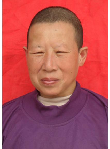 走失者照片 临沂寻亲：中年女子被救助，高1米6...