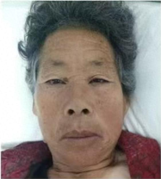 走失者照片 连云港市寻人：七旬老太走失，患脑梗...