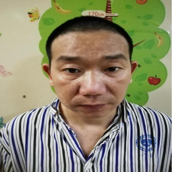 走失者照片 寻亲：中年男子在桂林被救助多年，无...