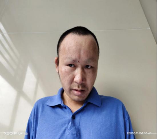 走失者照片 桂林寻亲：中年男子被救助多年，沟通...