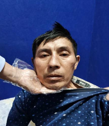 走失者照片 凉山会理寻亲：中年男子被救助，穿藏...