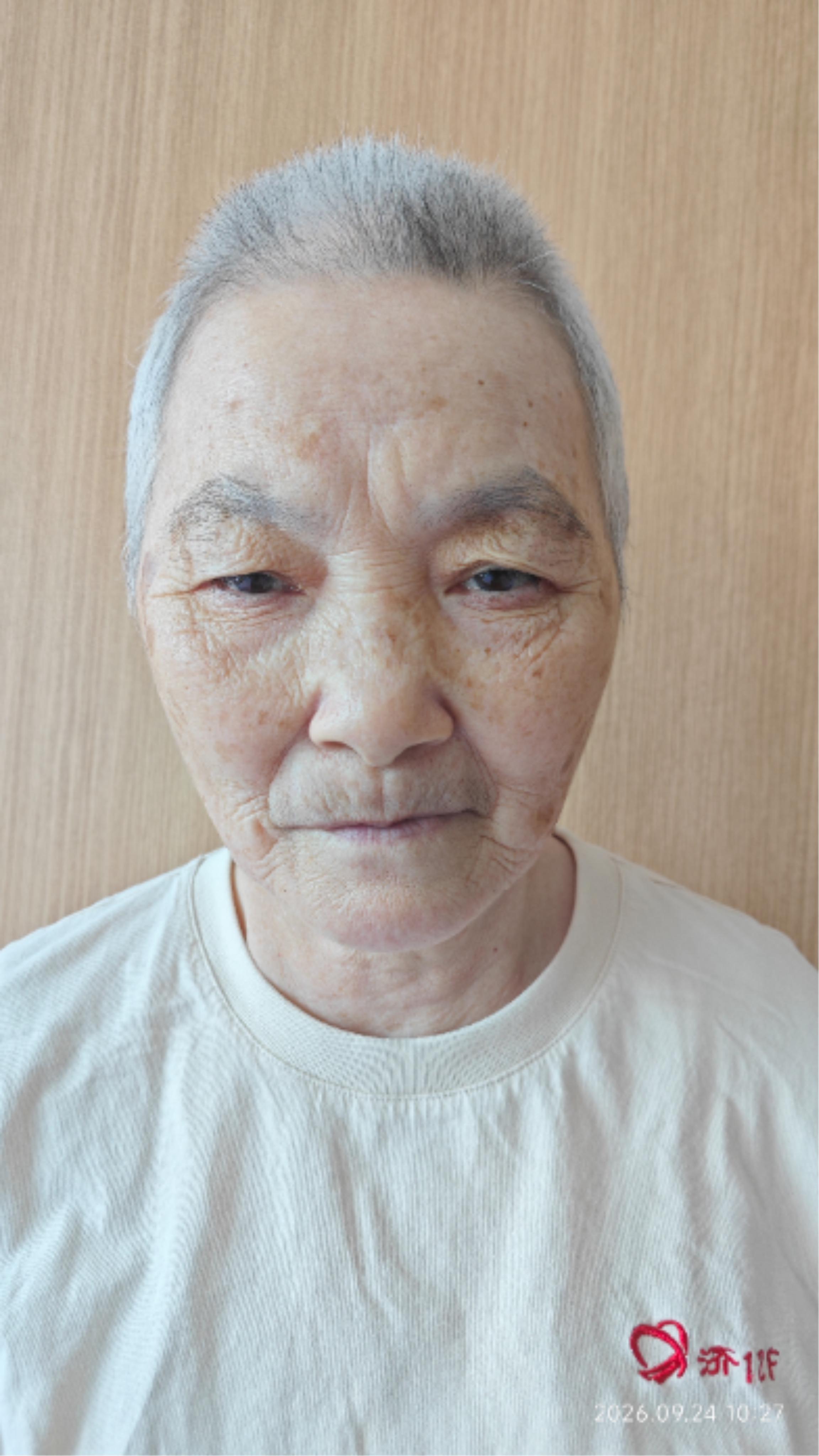 走失者照片 厦门市寻亲：六旬老太被救助多年，疑...