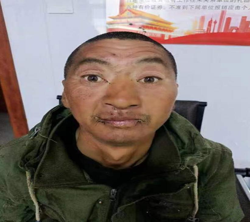 走失者照片 兴安盟寻亲：五旬男子被救助，自述叫...