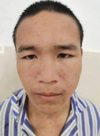 走失者照片 赣州寻亲：青年男子被救助数月，高1...
