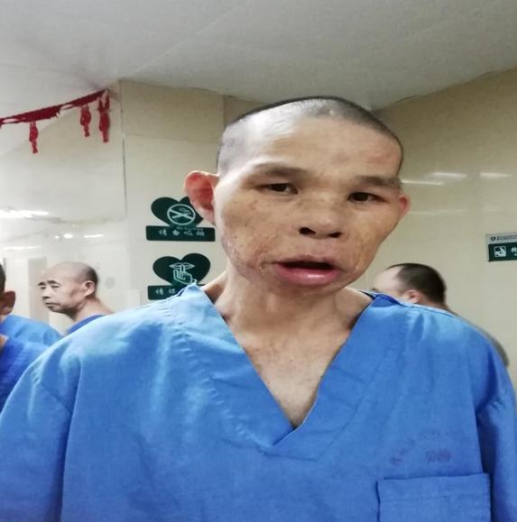 走失者照片 桂林寻亲：中年男子被救助多年，不说...