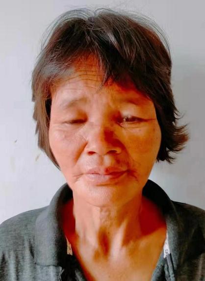 走失者照片 玉林寻亲：六旬老太被救助，自述叫陈...
