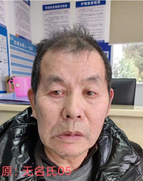 走失者照片 赣州寻亲！六旬老人被救助数年，穿灰...