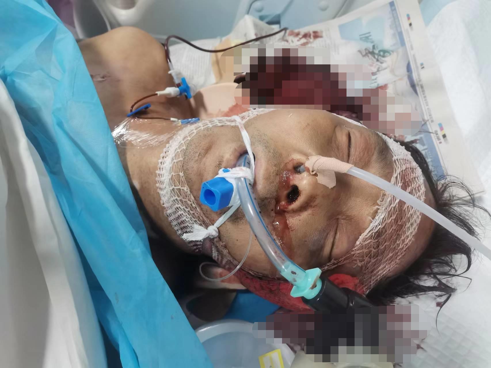 走失者照片 患者寻亲：洛阳中年男子遭遇车祸被送...
