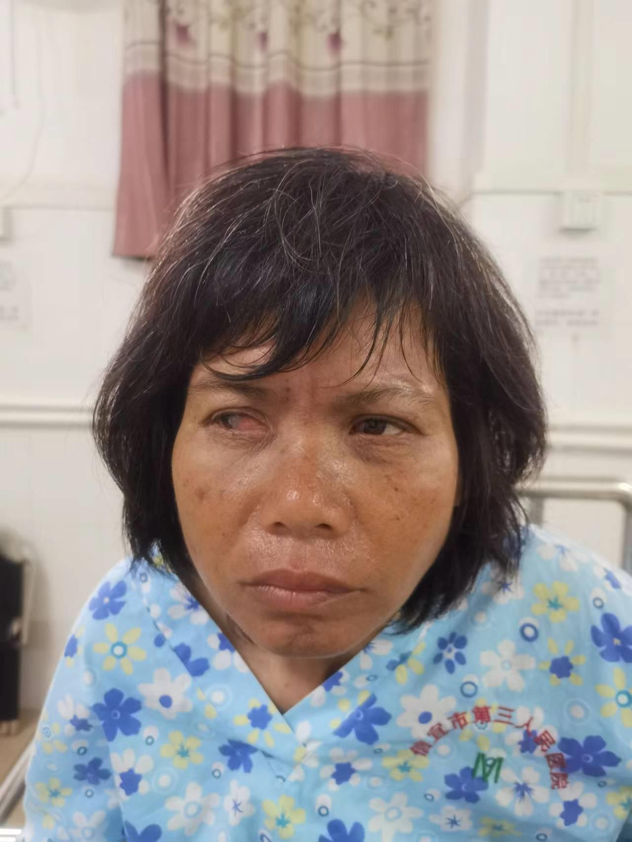 走失者照片 帮她回家：中年女子在茂名信宜被救助...
