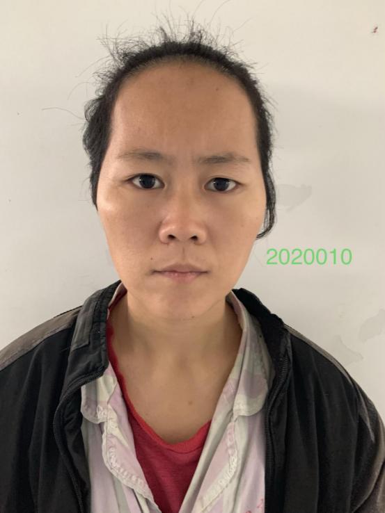 走失者照片 南宁寻亲：青年女子被救助数月，自述...