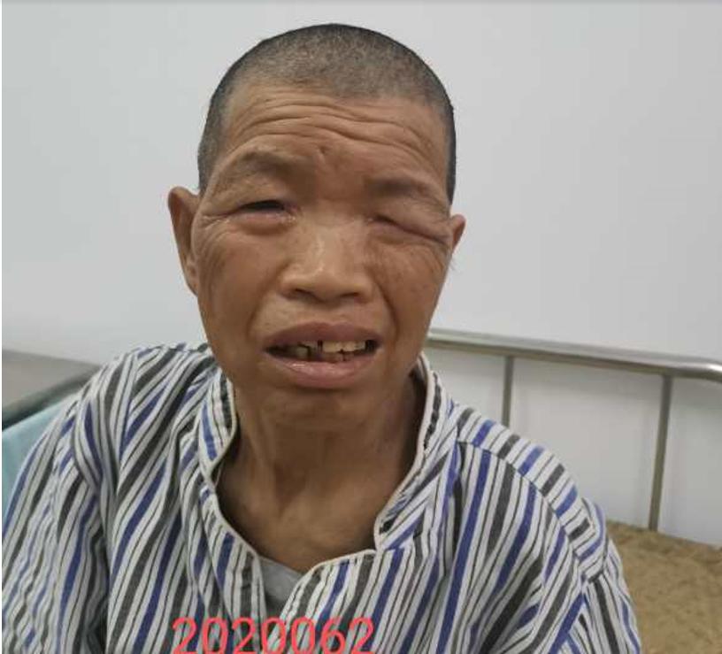 走失者照片 南宁寻亲：中年女子被救助，高1米4...