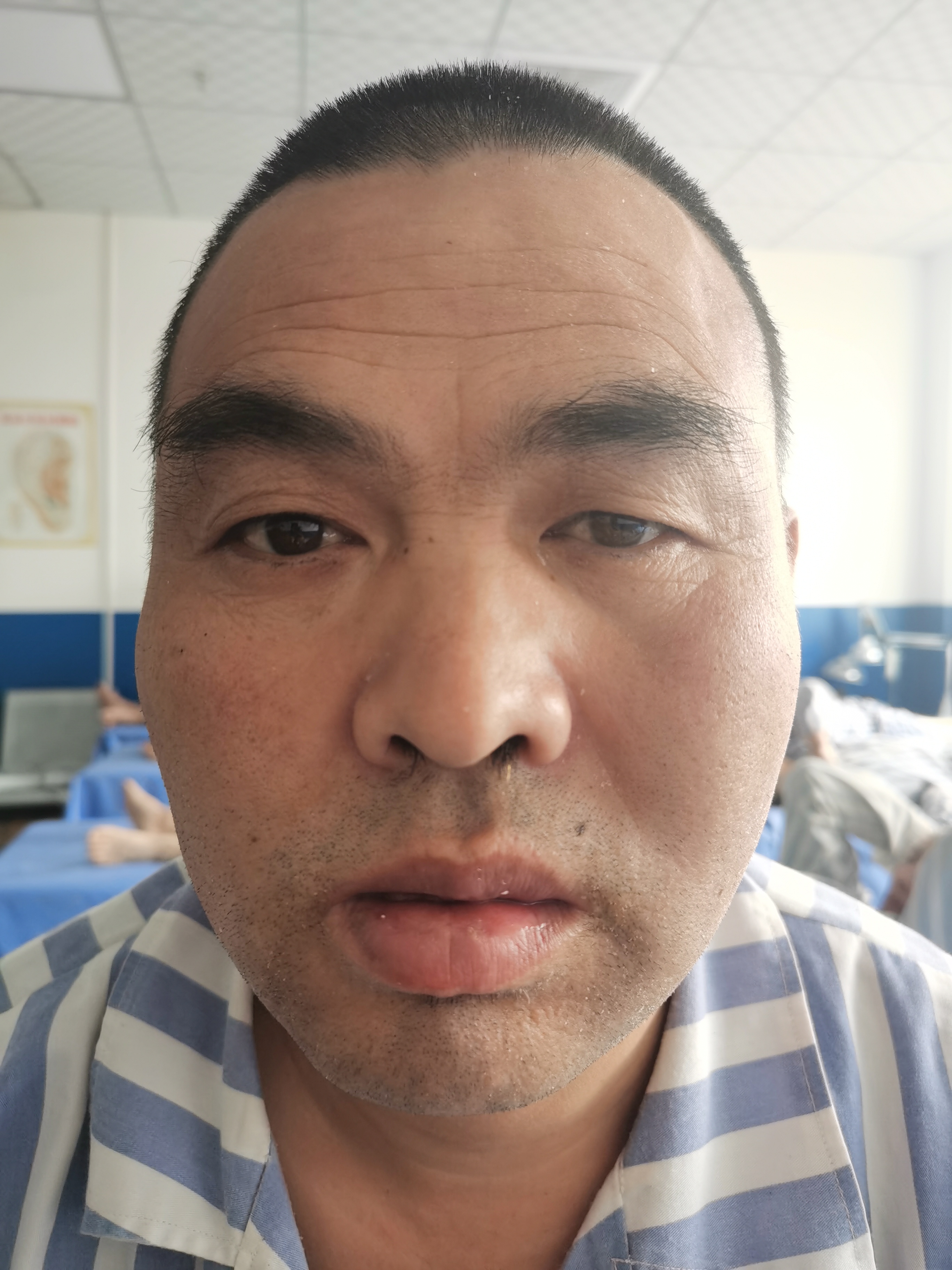 走失者照片 庆阳寻亲：青年男子被救助，自述叫刘...