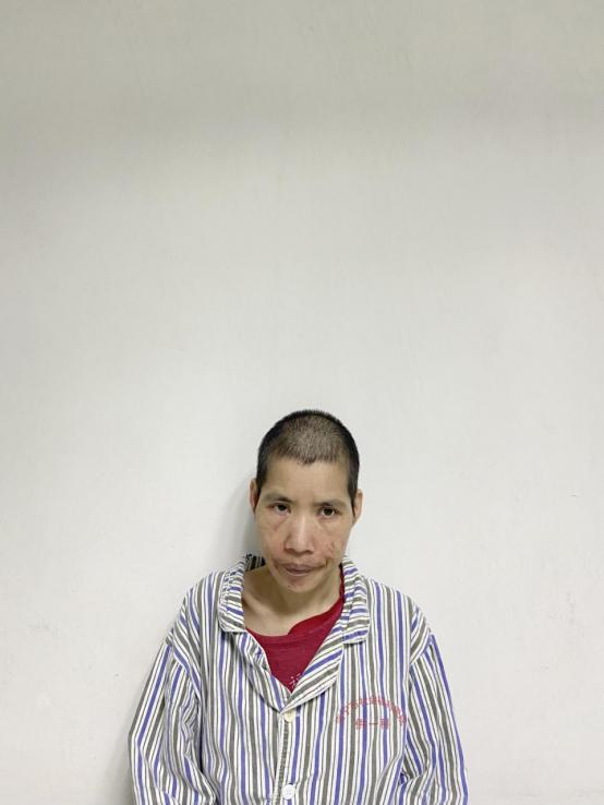 走失者照片 南宁寻亲：五旬女子被救助，高1米6...