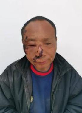 走失者照片 周口项城寻亲：中年男子被救助，穿黑...