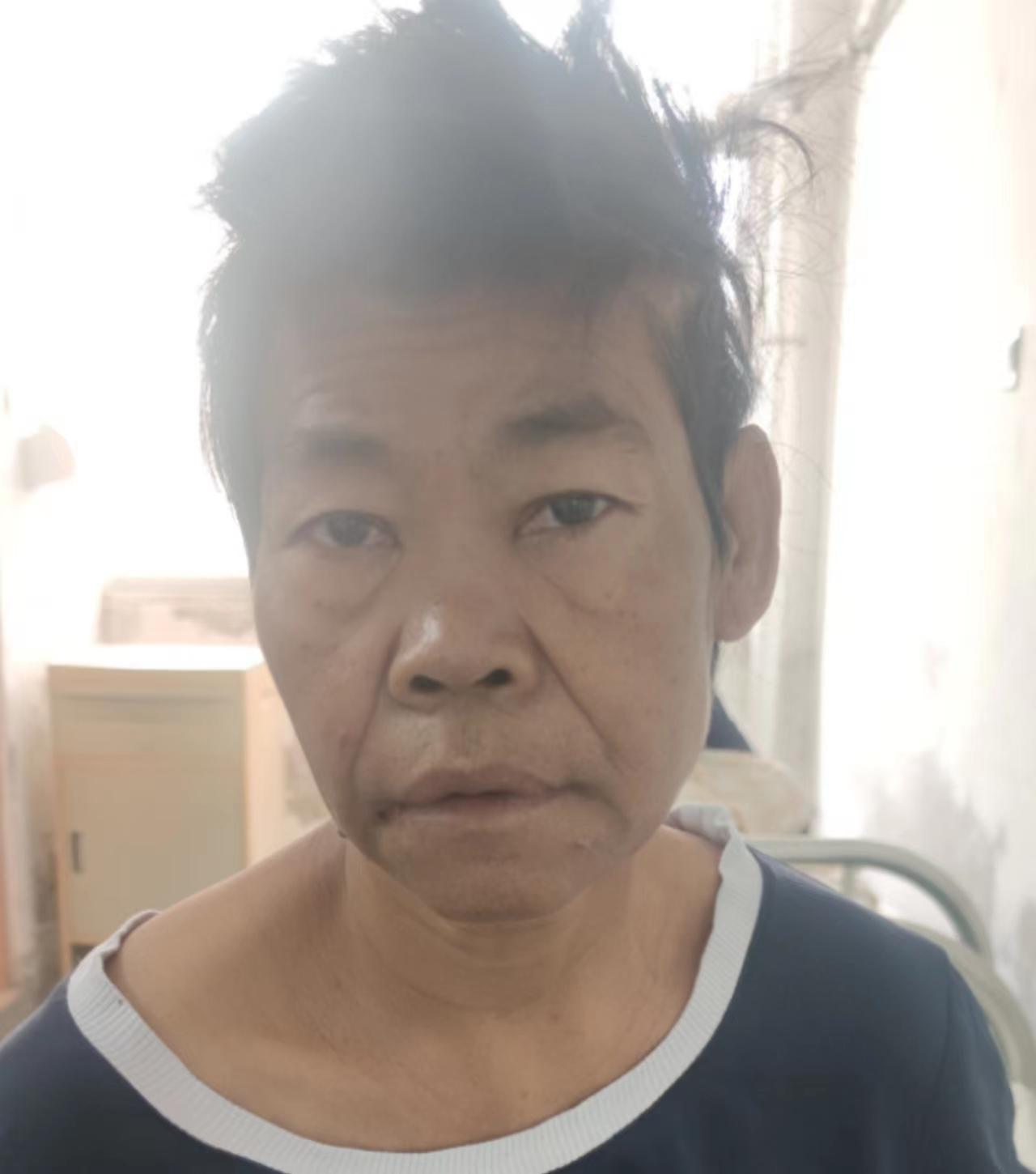 走失者照片 惠州寻亲：中年女子被救助，高1米5...