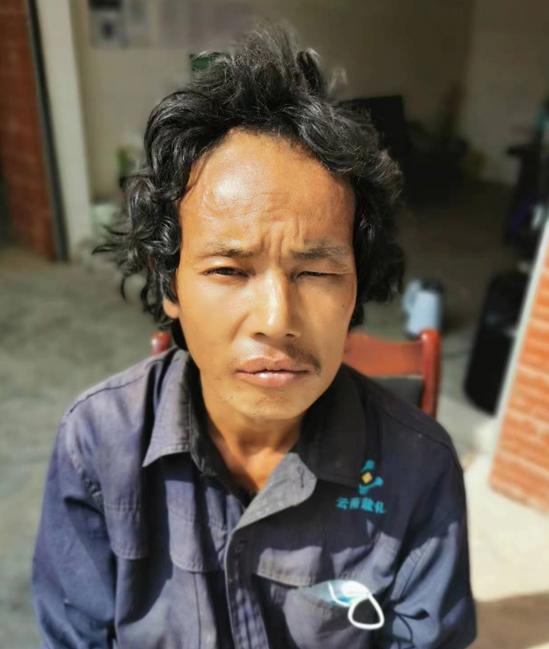 走失者照片 楚雄州寻亲：中年男子被救助，哑巴，...