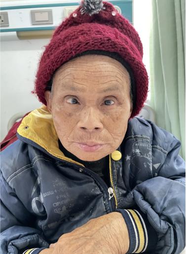 走失者照片 楚雄州寻亲：八旬老太被救助，系聋哑...