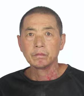 走失者照片 帮他回家：五旬男子在六安被救助多年...