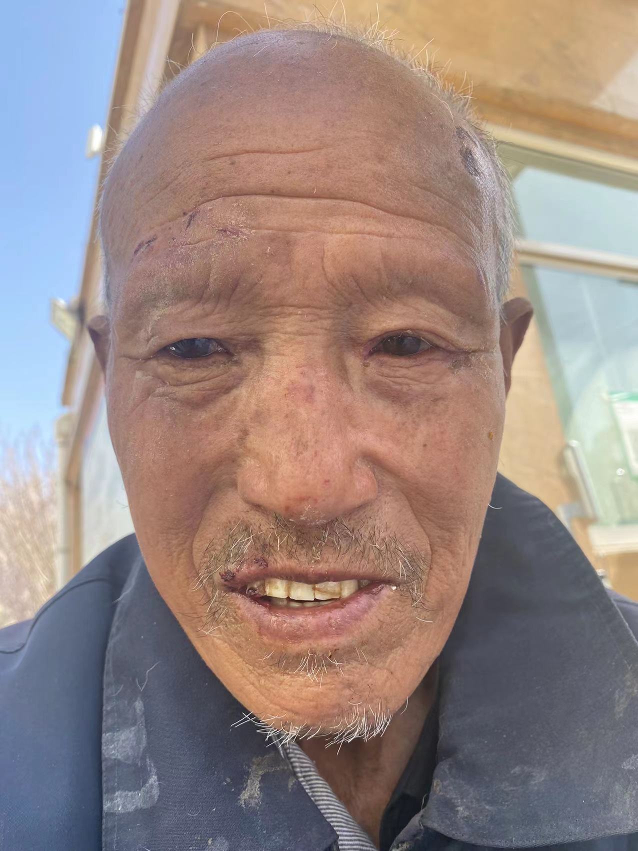 走失者照片 平凉寻亲：八旬老人被救助，自述叫王...