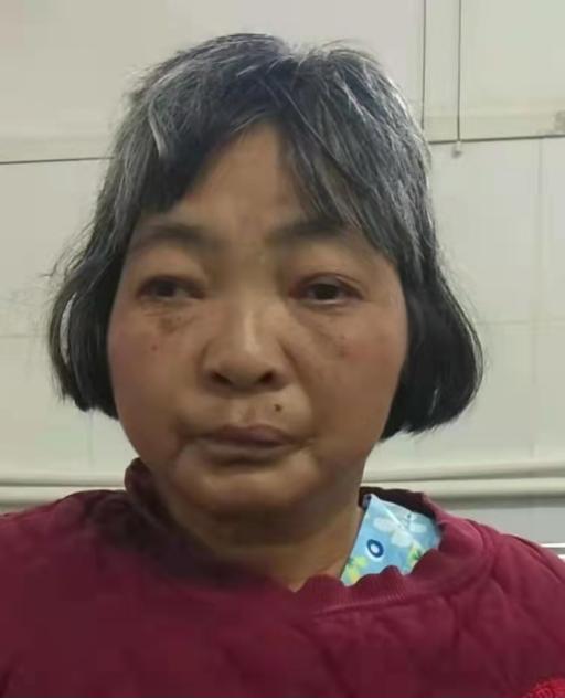 走失者照片 茂名寻亲：信宜五旬女子被救助，灰白...