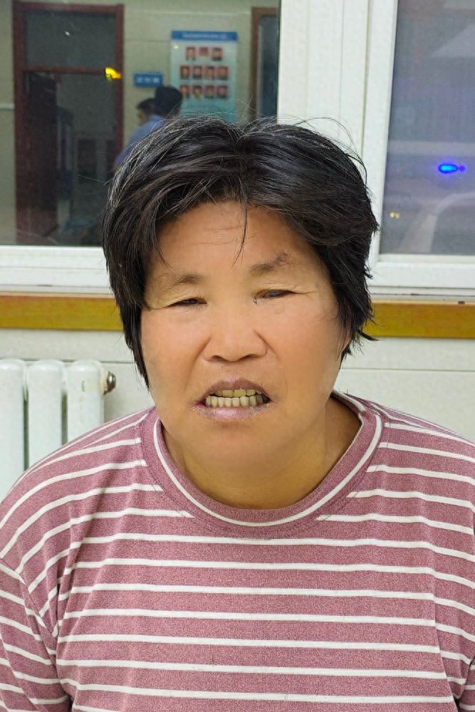 走失者照片 渭南市寻亲：五旬女子被救助，穿条纹...