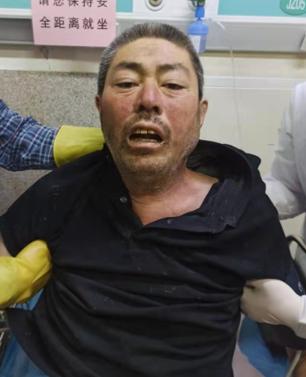 走失者照片 北京寻亲：五旬男子被救助，患病，无...