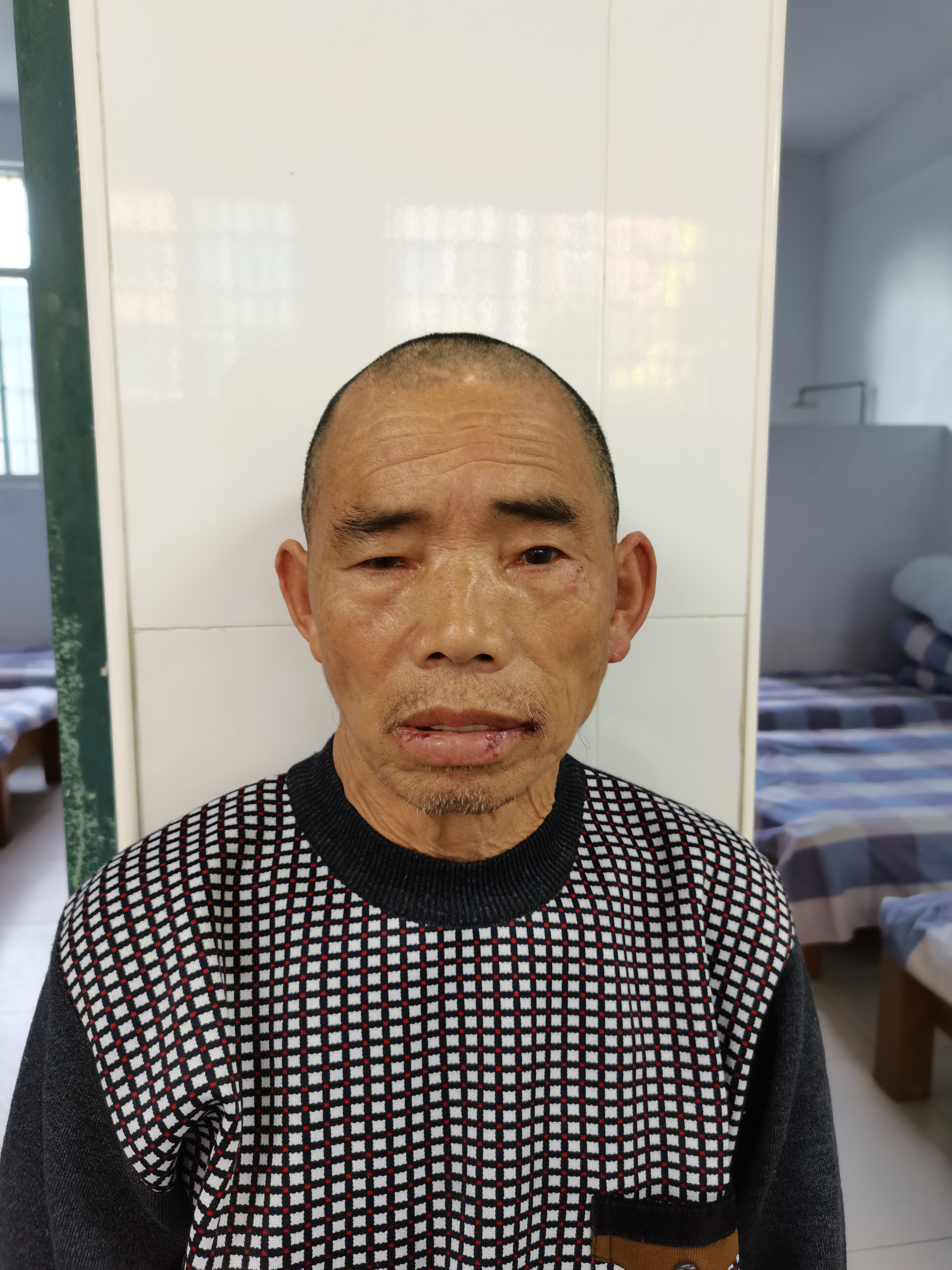 走失者照片 常德寻亲：五旬男子被救助，聋哑人，...