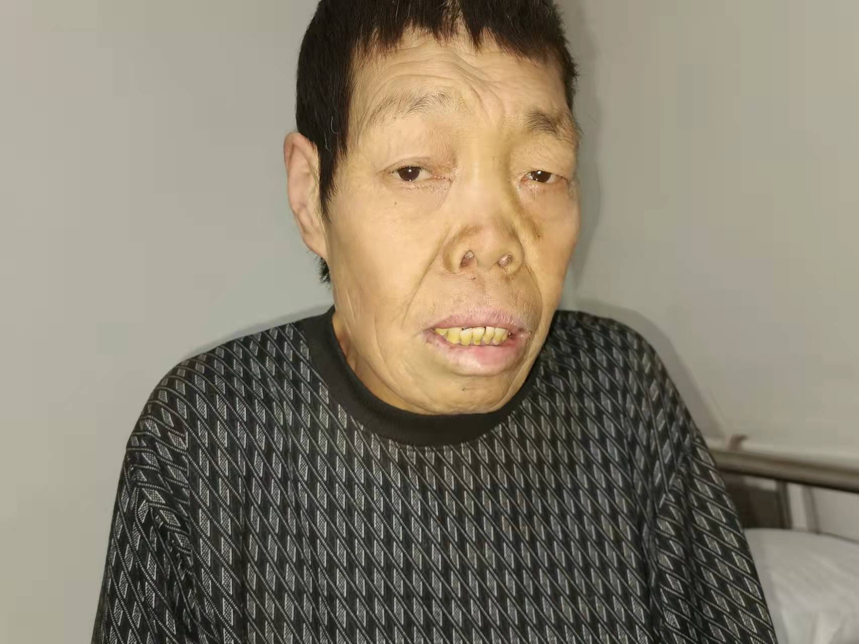 走失者照片 佳木斯寻亲:六旬老人被救助,自述叫...