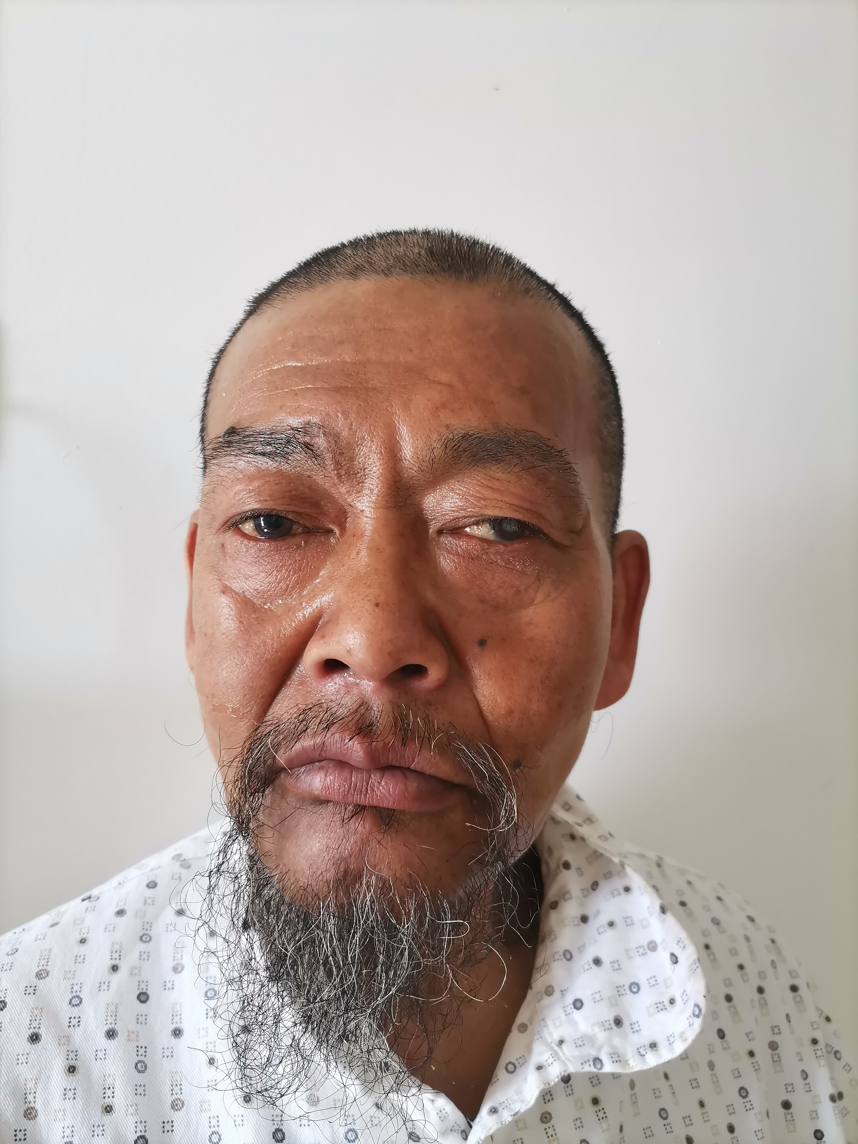 走失者照片 咸阳寻亲：六旬老人被救助，高1米6...
