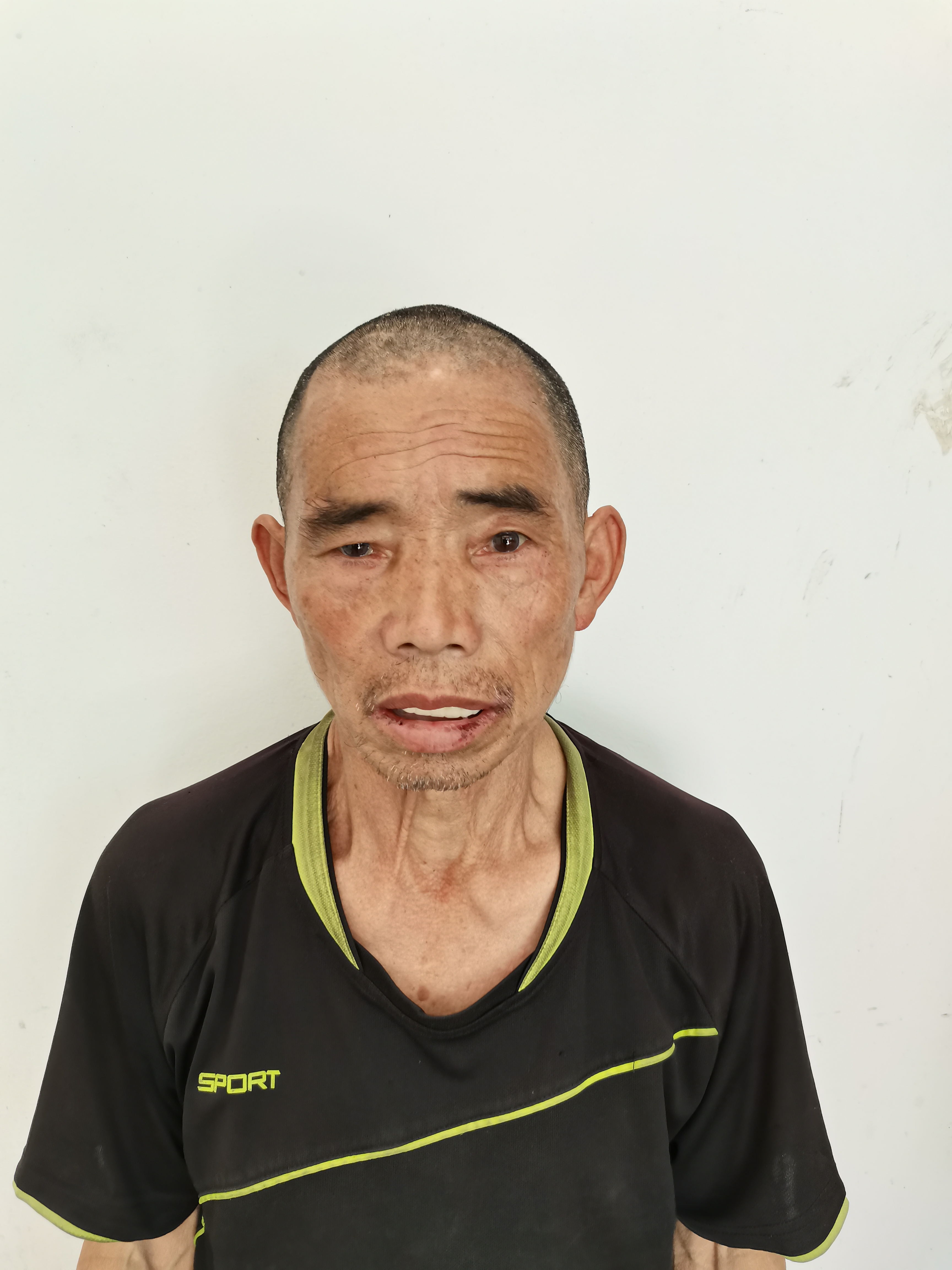 走失者照片 常德寻亲：五旬男子被救助，系聋哑人...