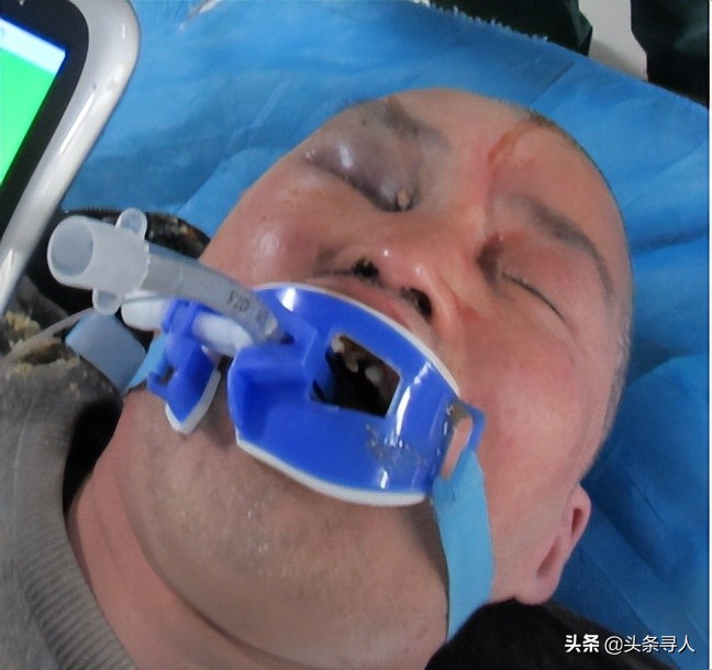 走失者照片 急寻亲属：六旬老人在鞍山海城市身亡...