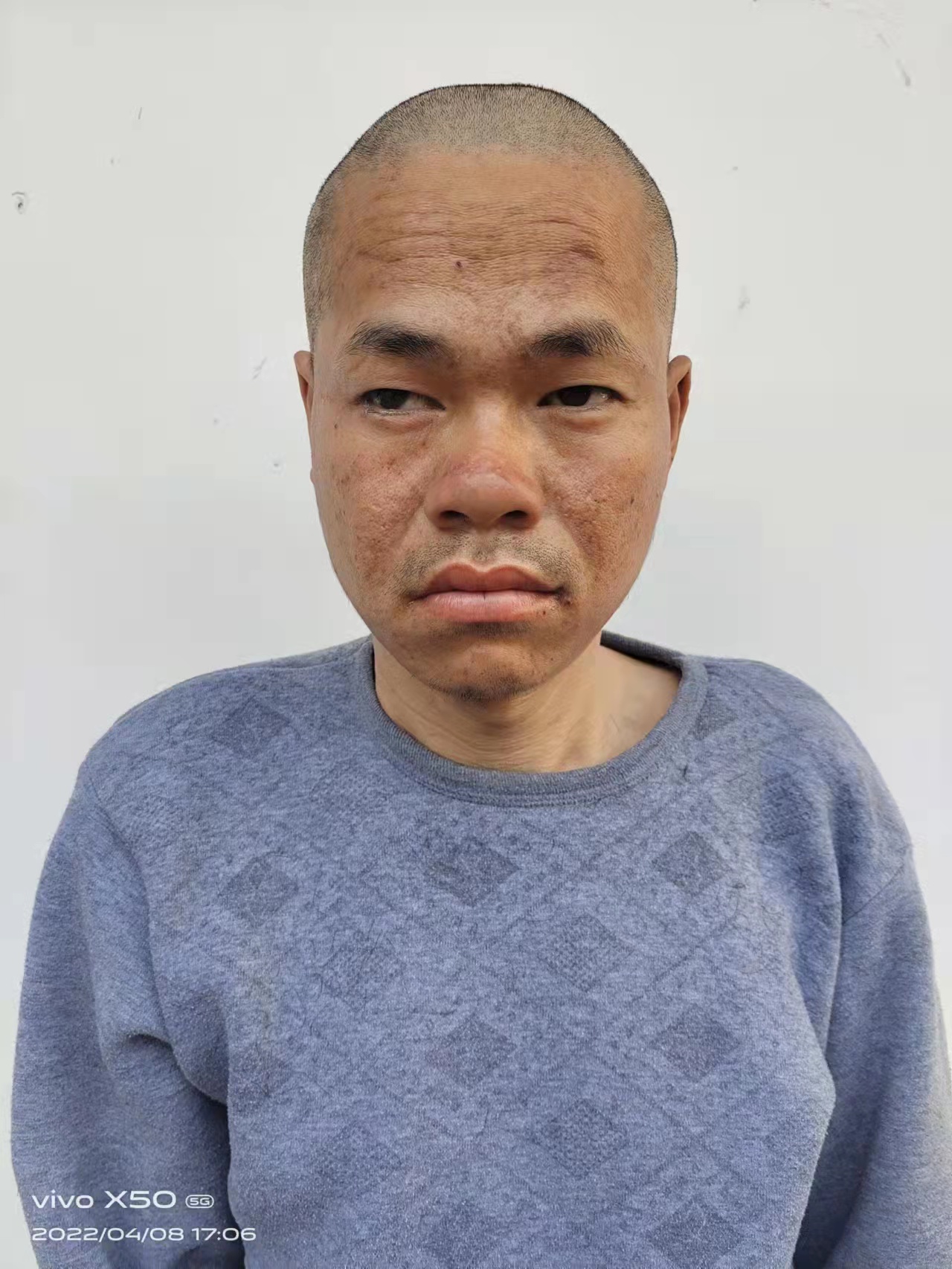 走失者照片 来宾寻亲：中年男子被救助，穿黑色棉...