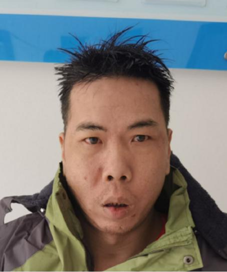 走失者照片 黔南州寻亲：都匀青年男子被救助，穿...