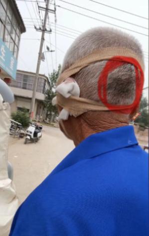 走失者照片 聊城寻人：七旬老人走失，患阿尔茨海...